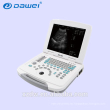 Tragbare tragbare Ultraschallmaschine des Ultraschalls DW-500 für Schwangerschaft